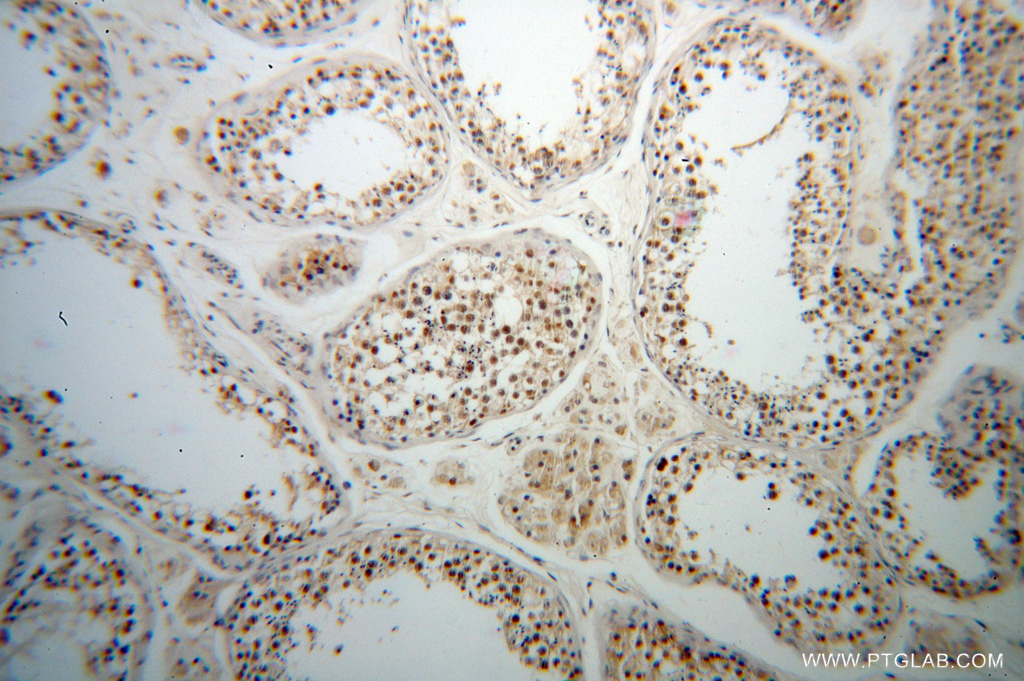 IHC staining of human testis using 13709-1-AP