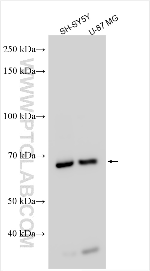 WB analysis using 17377-1-AP