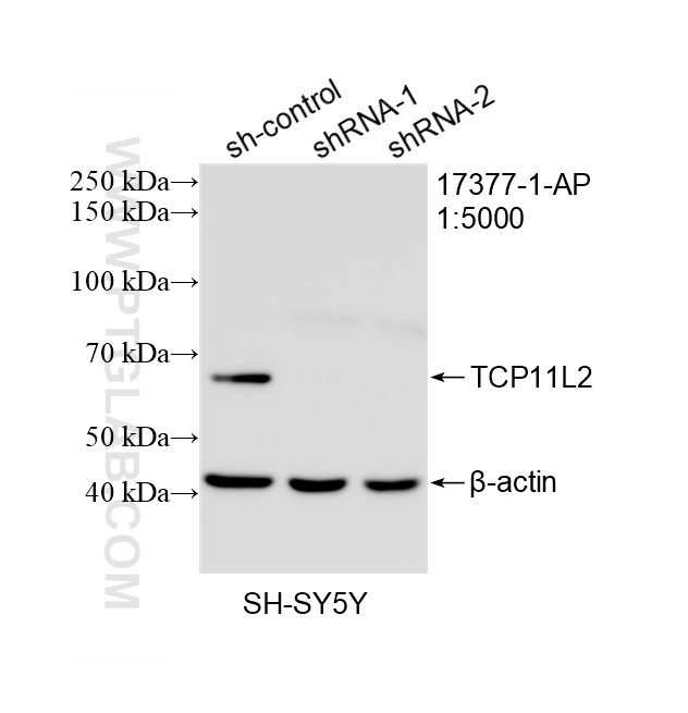 WB analysis of SH-SY5Y using 17377-1-AP