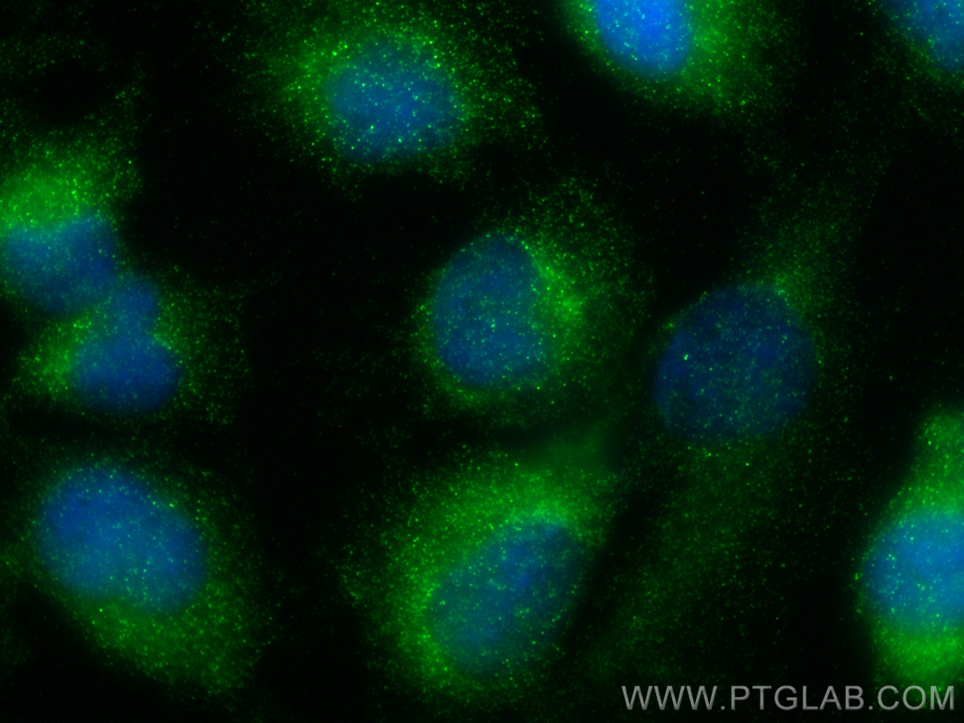 IF Staining of U-251 using 83227-1-RR (same clone as 83227-1-PBS)