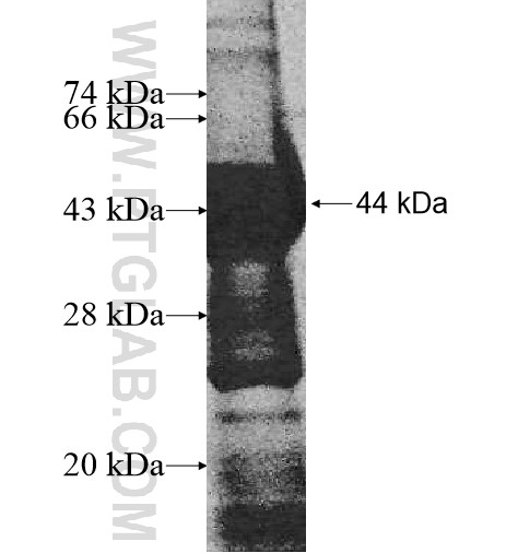TCTE1 fusion protein Ag10759 SDS-PAGE TCTE1 fusion protein Ag10759 SDS-PAGE