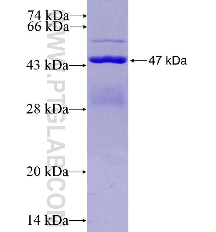 TCTEX1D1 fusion protein Ag16244 SDS-PAGE TCTEX1D1 fusion protein Ag16244 SDS-PAGE