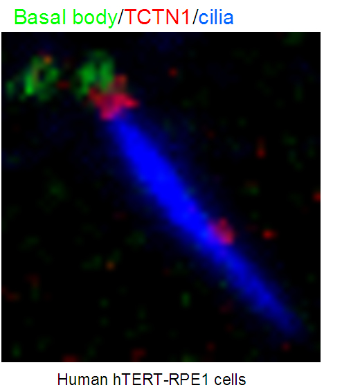 TCTN1 Polyclonal antibody