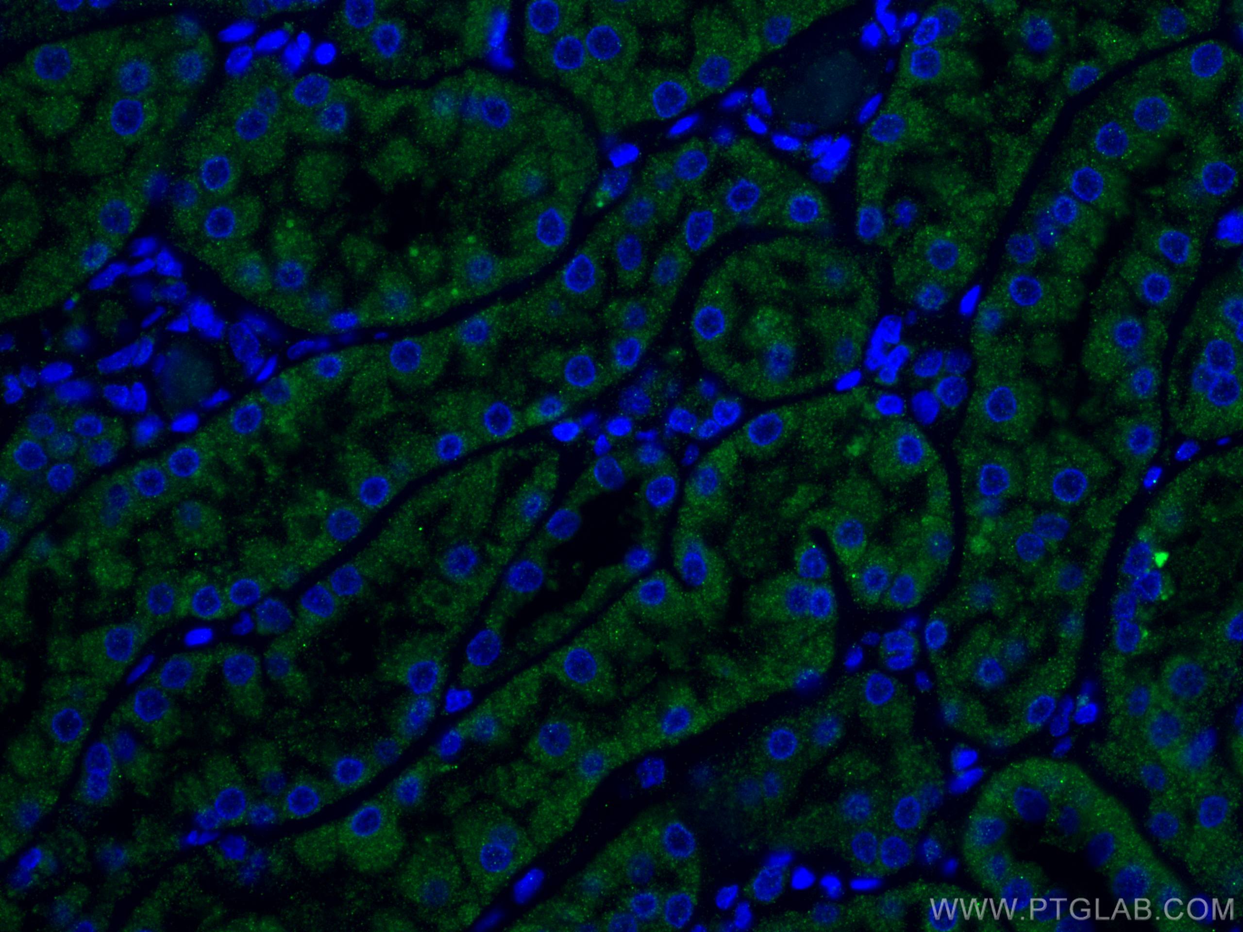 IF Staining of human kidney using 15004-1-AP