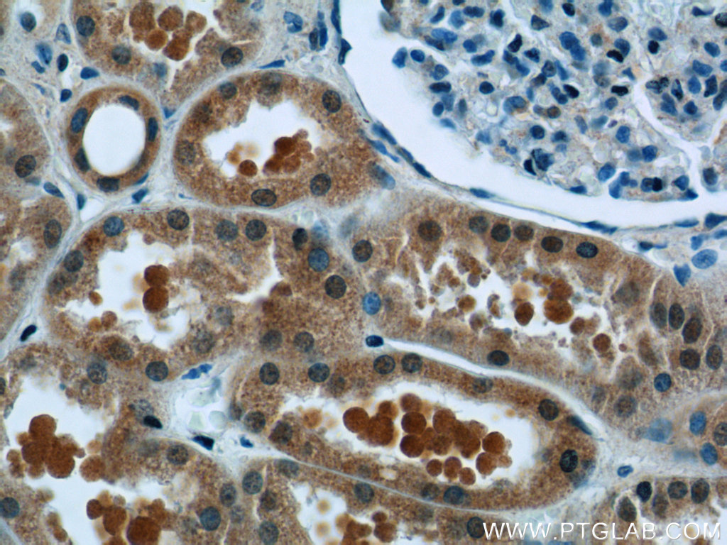 IHC staining of human kidney using 15004-1-AP