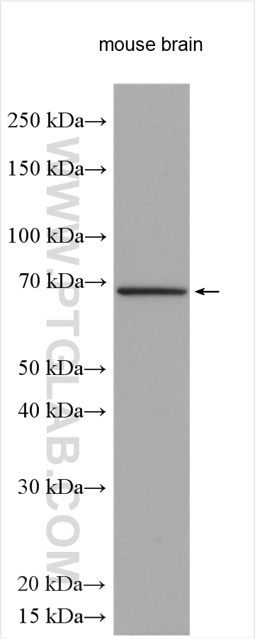 TCTN1