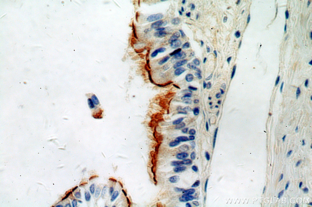 IHC staining of human lung using 16085-1-AP (same clone as 16085-1-PBS)