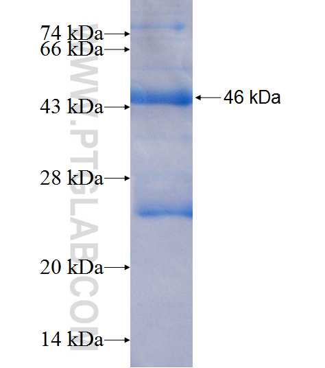 TCTN3 fusion protein Ag9106 SDS-PAGE TCTN3 fusion protein Ag9106 SDS-PAGE