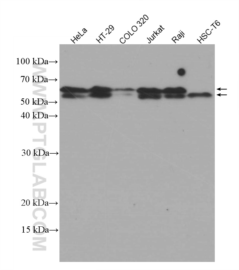 WB analysis using 66707-1-Ig