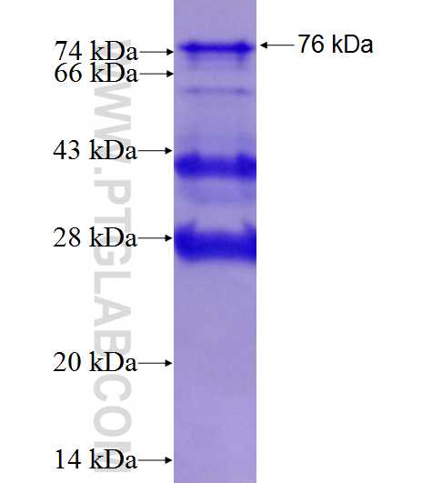 TDG fusion protein Ag4190 SDS-PAGE