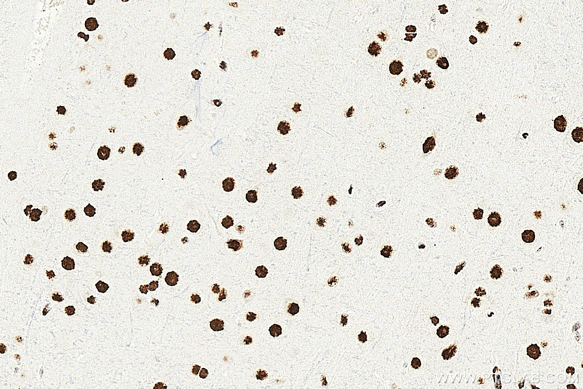 IHC staining of rat brain using 67345-1-Ig