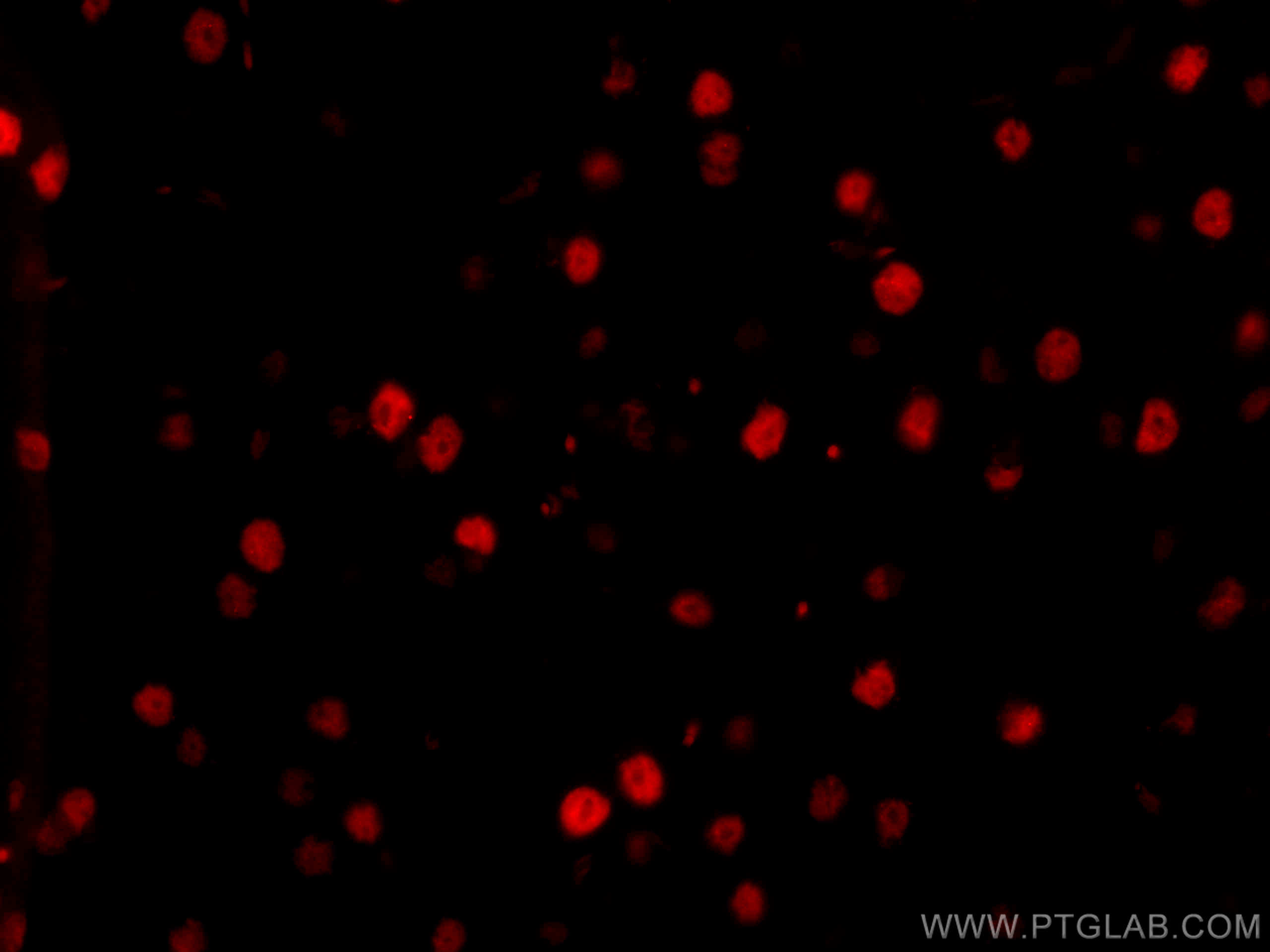 IF Staining of mouse brain using CL594-80002