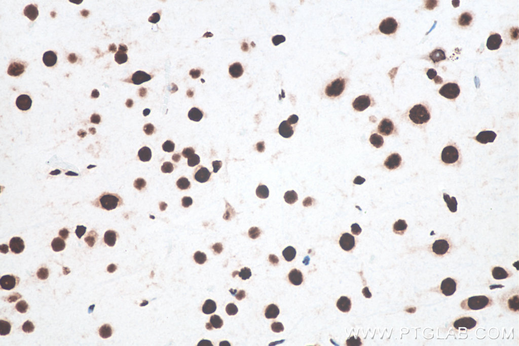 IHC staining of rat brain using 80001-1-RR IHC staining of rat brain using 80001-1-RR