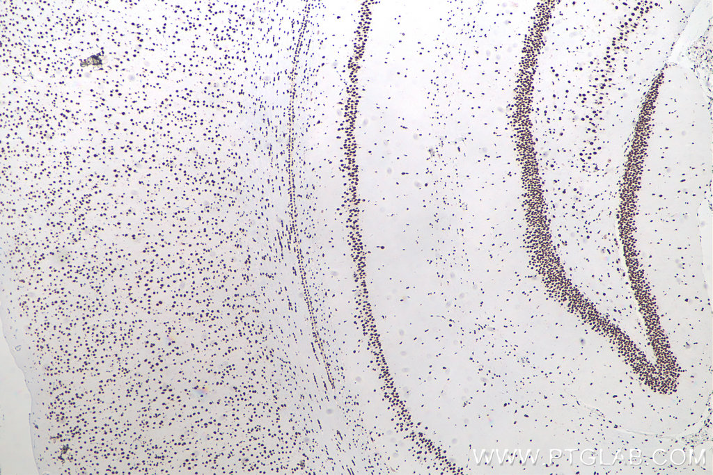 IHC staining of rat brain using 80001-1-RR IHC staining of rat brain using 80001-1-RR