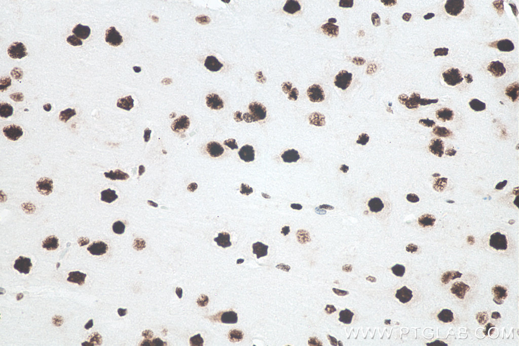 IHC staining of human brain using 80001-1-RR IHC staining of human brain using 80001-1-RR