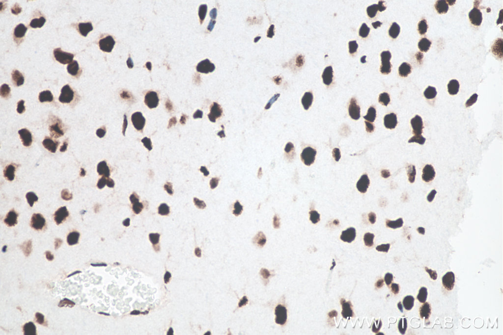 IHC staining of mouse brain using 80001-1-RR IHC staining of mouse brain using 80001-1-RR