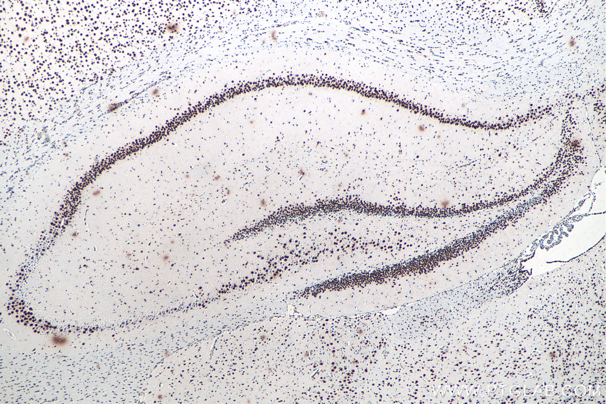 IHC staining of rat brain using 80001-1-RR (same clone as 80001-1-PBS)