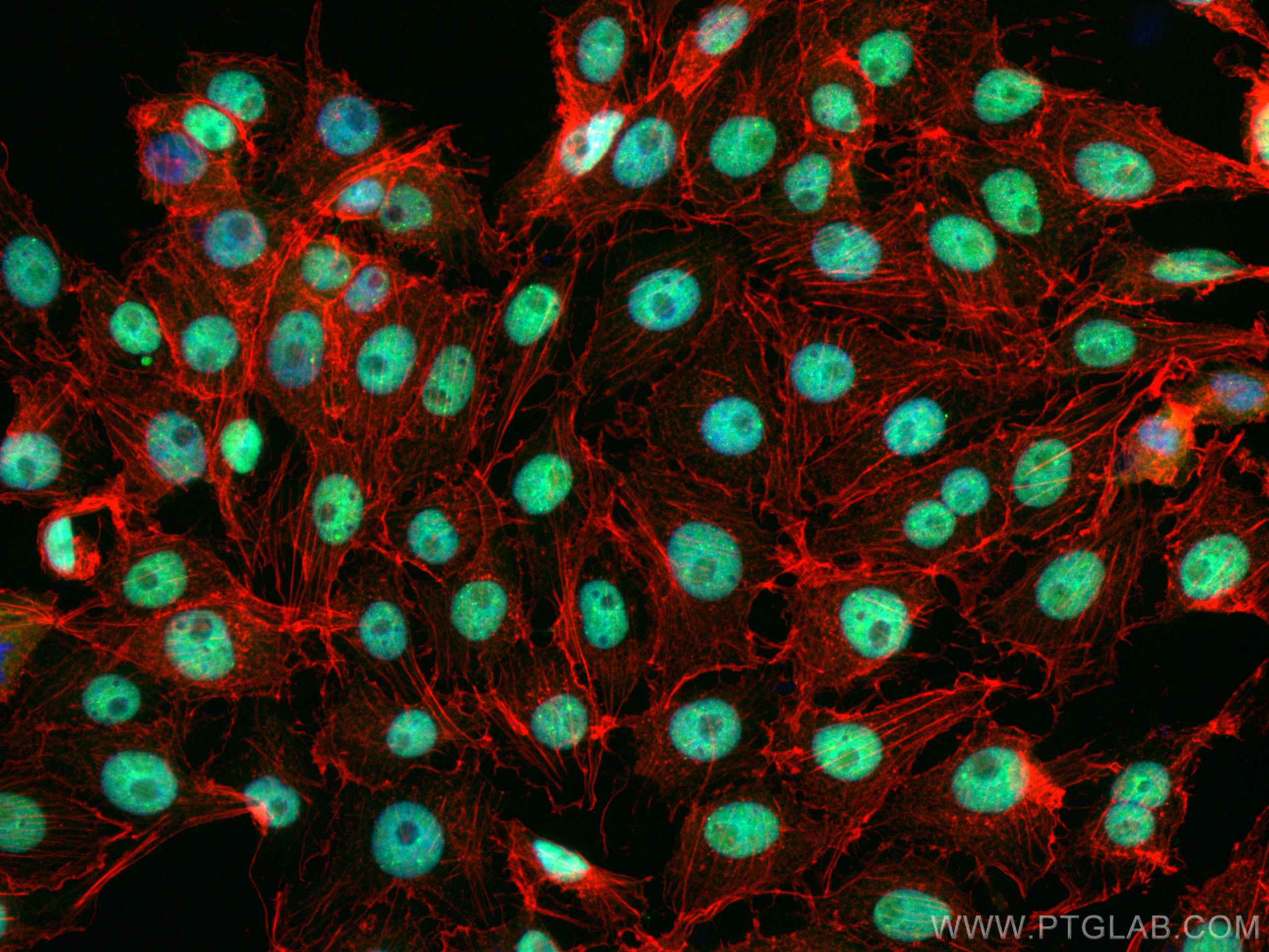 IF Staining of SH-SY5Y using 80002-1-RR (same clone as 80002-1-PBS)