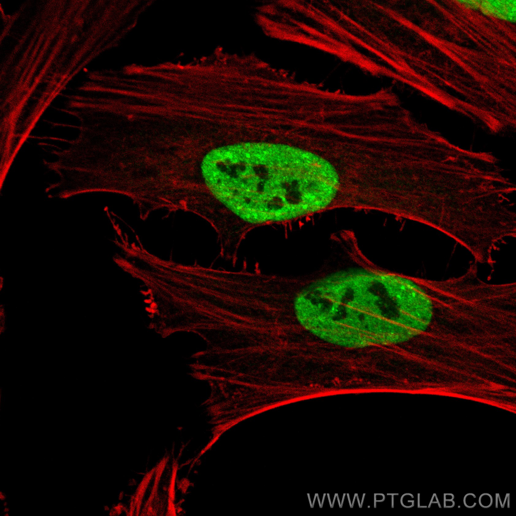 IF Staining of HeLa using 80002-1-RR