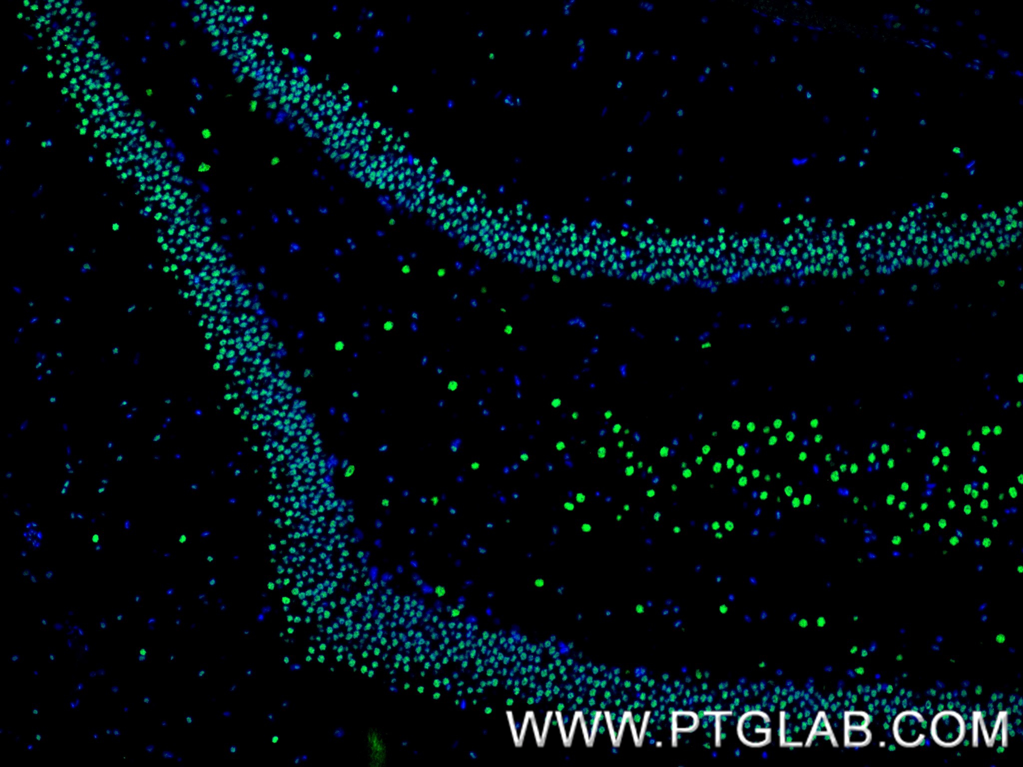IF Staining of rat brain using 80002-1-RR
