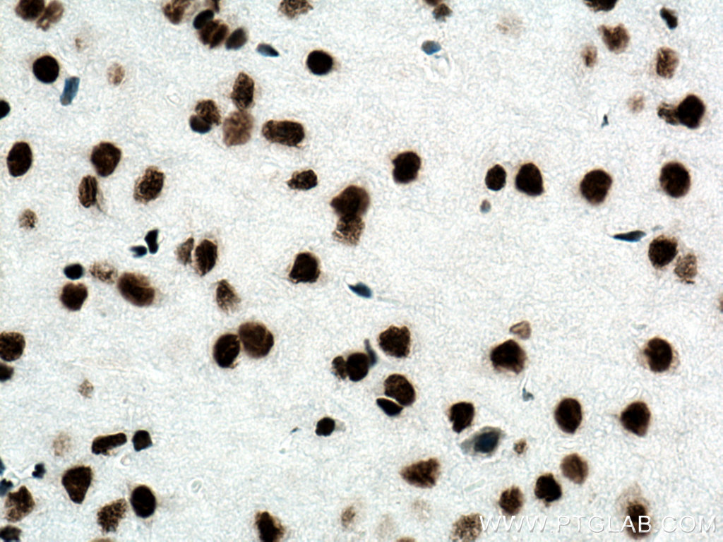 IHC staining of mouse brain using 80002-1-RR
