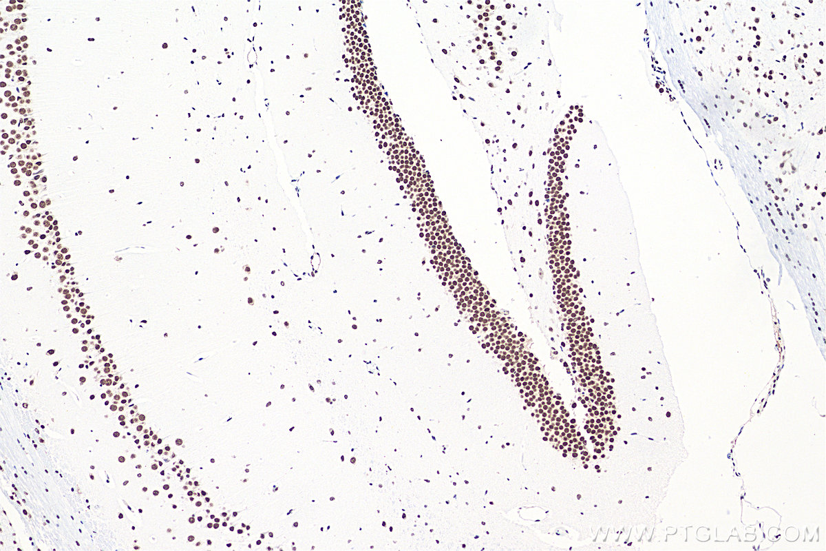 IHC staining of mouse brain using 81350-1-RR