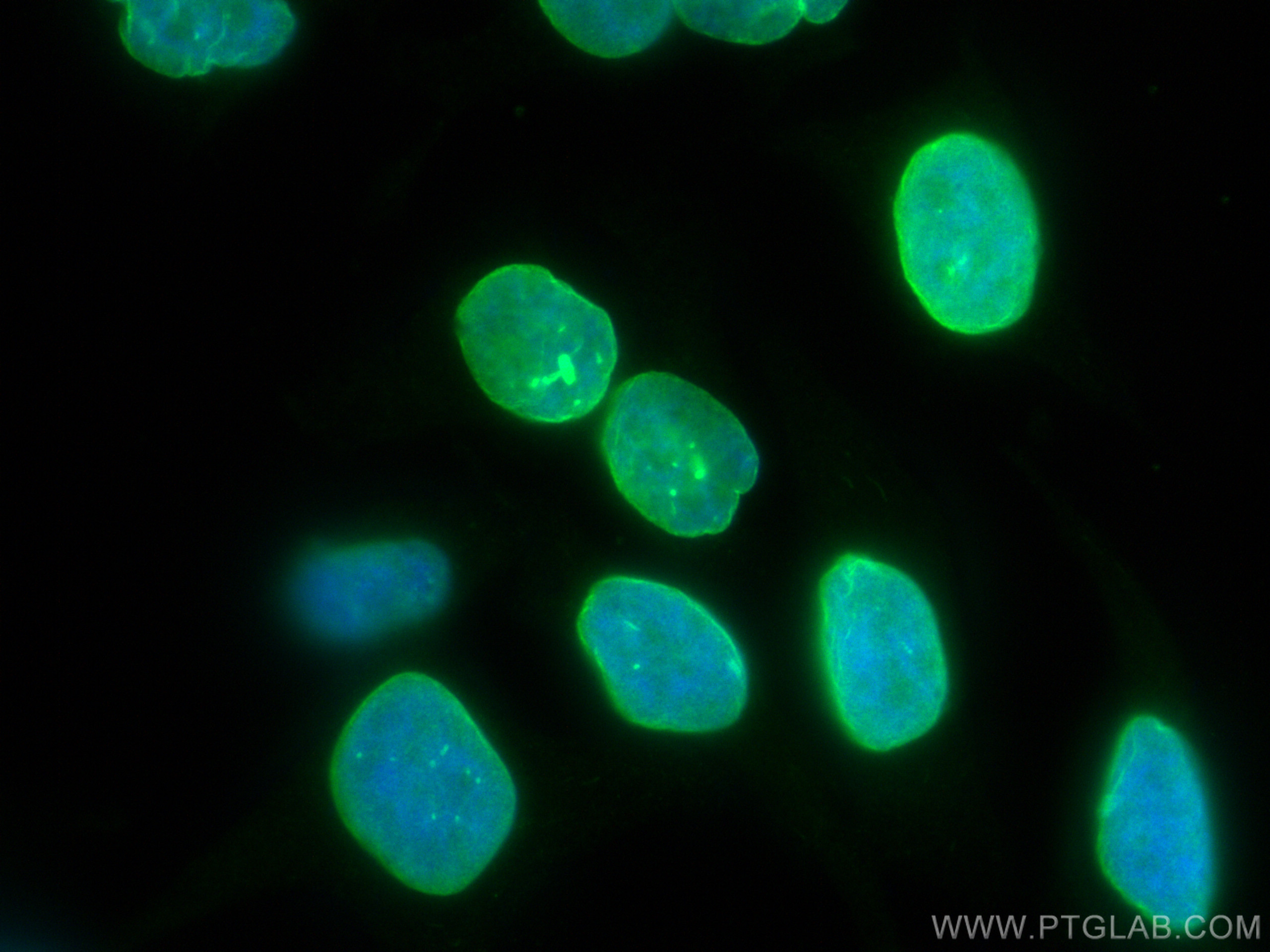 IF Staining of HeLa using CL488-80001