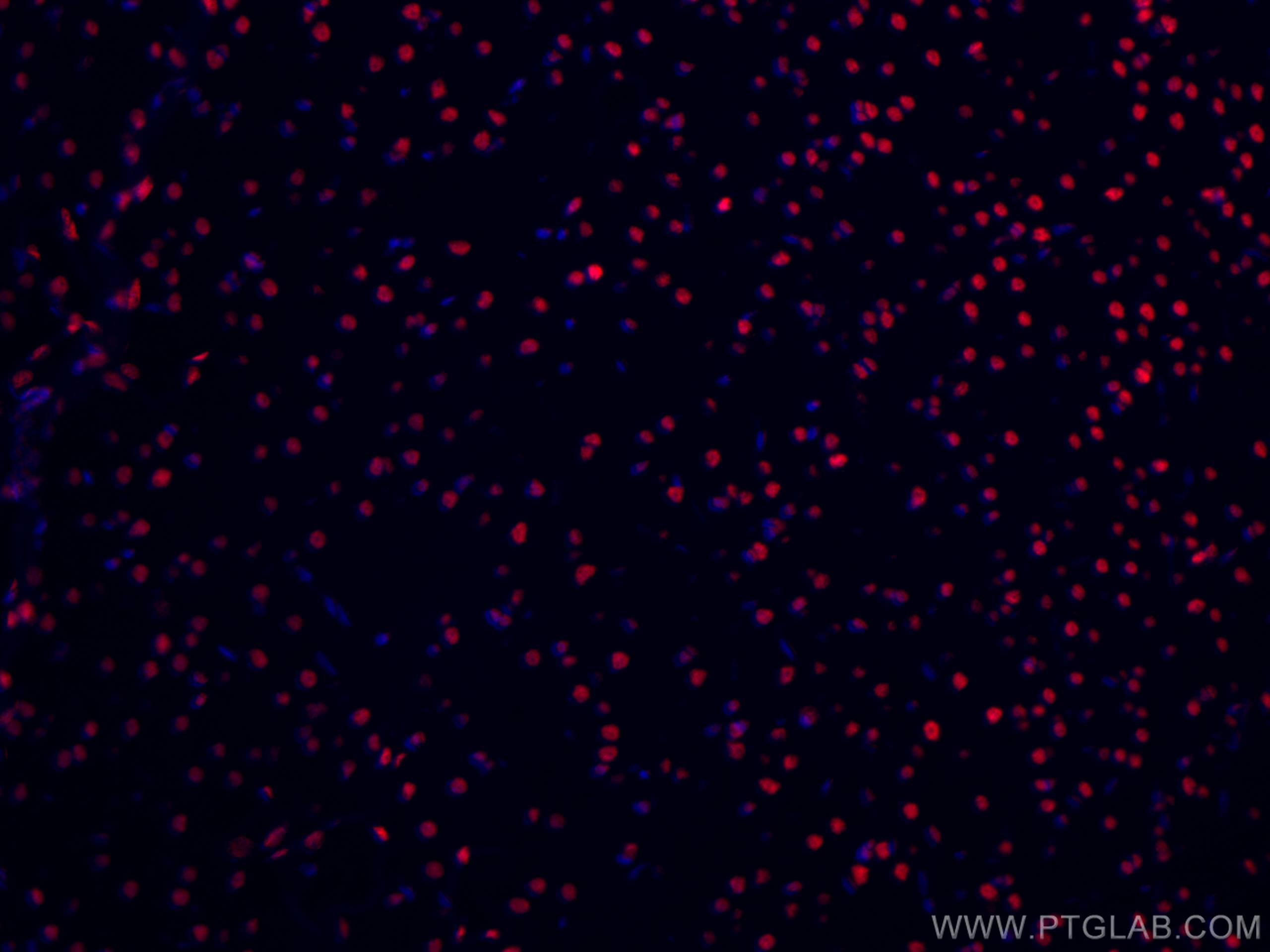 IF Staining of rat brain using CL594-67345