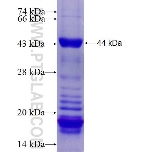 TDRD3 fusion protein Ag4351 SDS-PAGE TDRD3 fusion protein Ag4351 SDS-PAGE