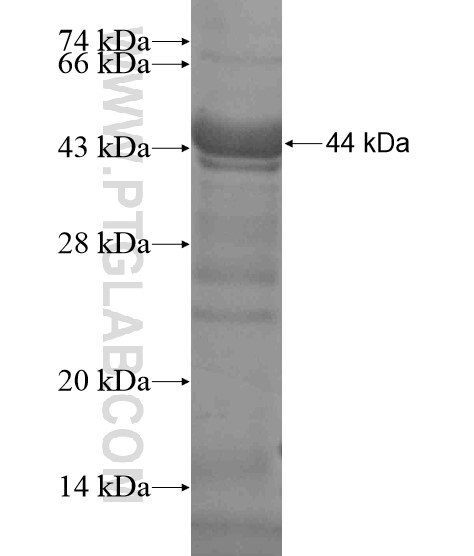 TDRD9 fusion protein Ag19070 SDS-PAGE TDRD9 fusion protein Ag19070 SDS-PAGE
