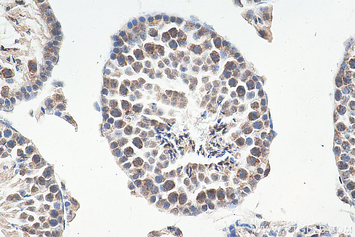 IHC staining of mouse testis using 66845-1-Ig (same clone as 66845-1-PBS)