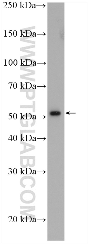 WB analysis of BGC-823 using 13283-1-AP