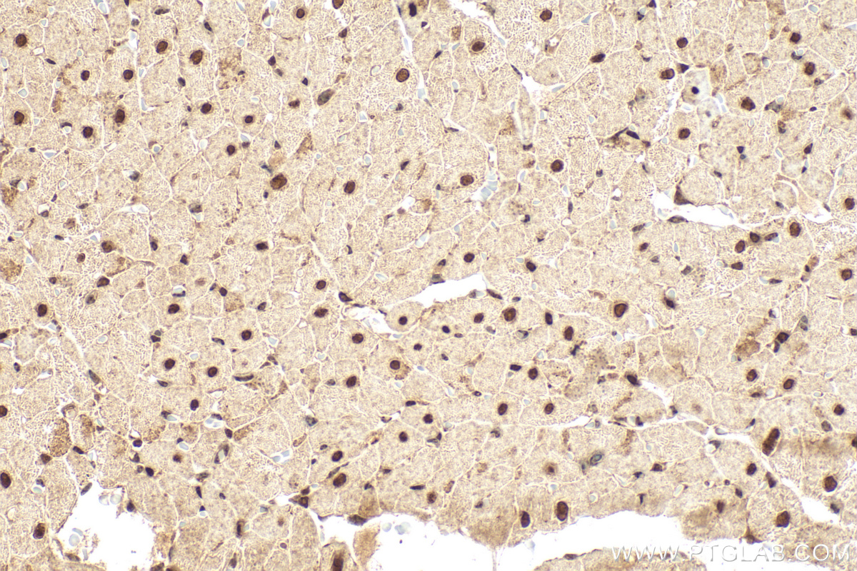 Immunohistochemical analysis of paraffin-embedded rat heart tissue slide using 13120-1-AP (TEAD3 antibody) at dilution of 1:400 (under 40x lens). Heat mediated antigen retrieval with Tris-EDTA buffer (pH 9.0). IHC staining of rat heart using 13120-1-AP
