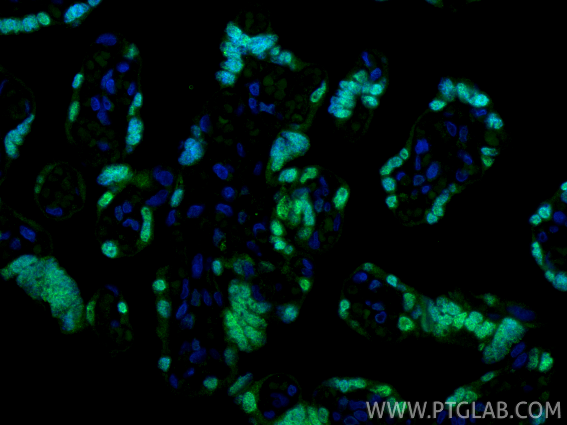 Immunofluorescent analysis of (4% PFA) fixed paraffin-embedded human placenta tissue using TEAD3 antibody (<a class='green' href='/productredirect?CatalogNo=68464-1-Ig' target='_blank'>68464-1-Ig</a>, Clone: 2E6A12 ) at dilution of 1:400 and CoraLite®488-Conjugated Goat Anti-Mouse IgG(H+L) (<a class='green' href='/productredirect?CatalogNo=SA00013-1' target='_blank'>SA00013-1</a>). Heat mediated antigen retrieval with Tris-EDTA buffer (pH 9.0). This data was developed using the same antibody clone with 68464-1-PBS in a different storage buffer formulation. IF Staining of human placenta using 68464-1-Ig (same clone as 68464-1-PBS)