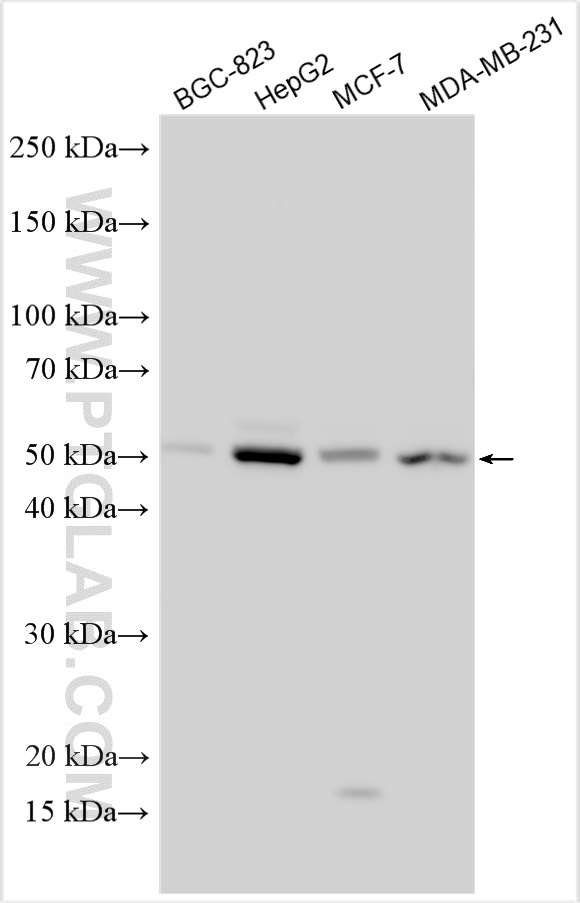 WB analysis using 12418-1-AP