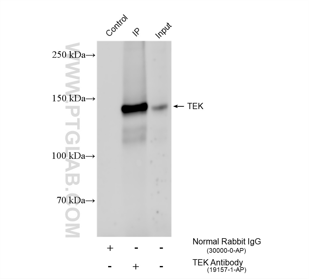 IP experiment of mouse lung using 19157-1-AP