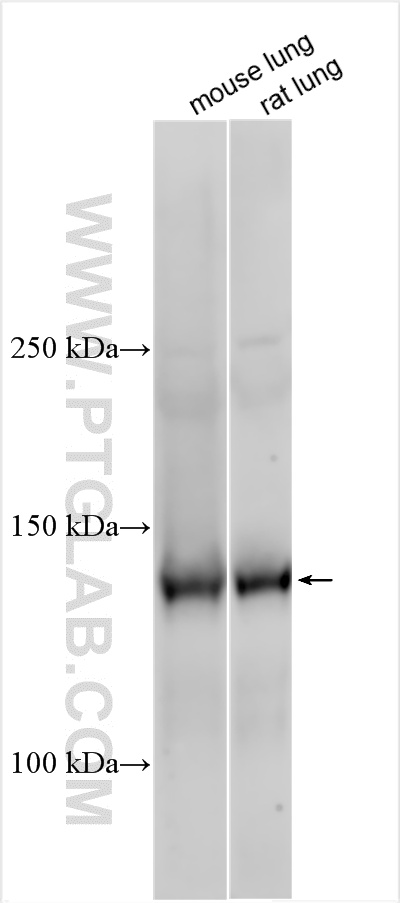 mouse lung tissue were subjected to SDS PAGE followed by western blot with 19157-1-AP (Tie-2/CD202b antibody) at dilution of 1:1000 incubated at room temperature for 1.5 hours. WB analysis of mouse lung using 19157-1-AP