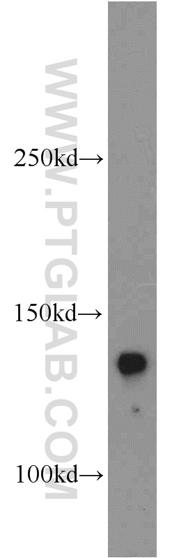 WB analysis of mouse lung using 19157-1-AP