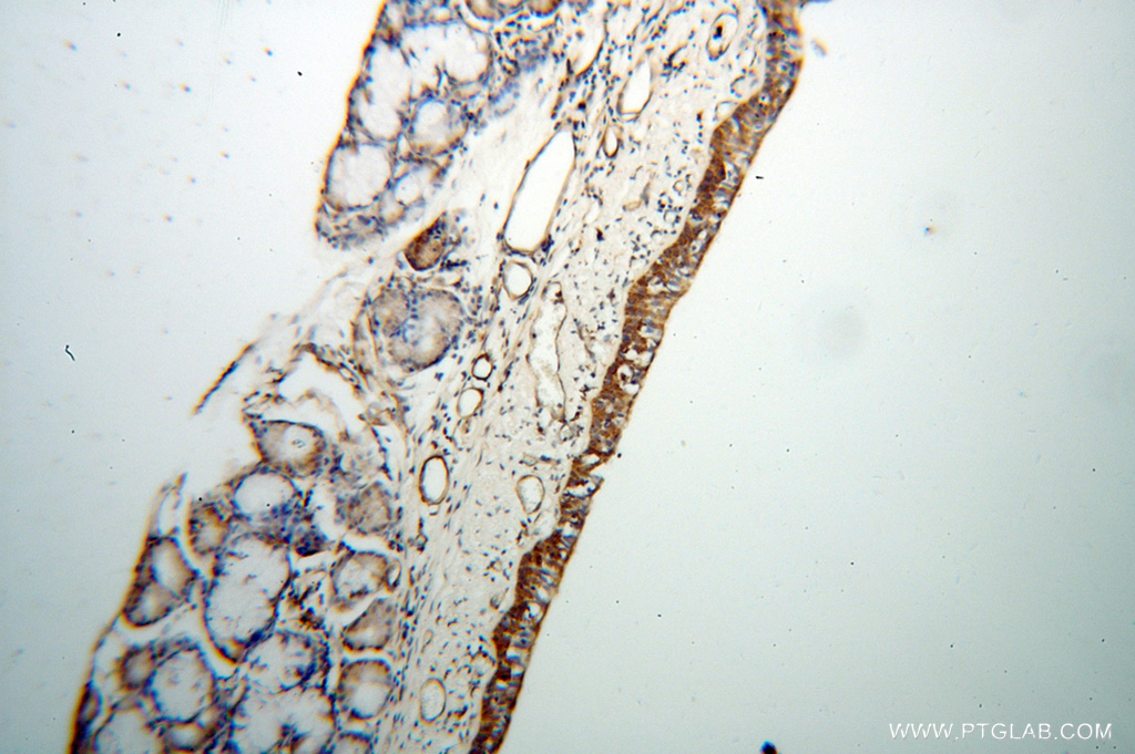 IHC staining of human trachea using 13518-1-AP (same clone as 13518-1-PBS)