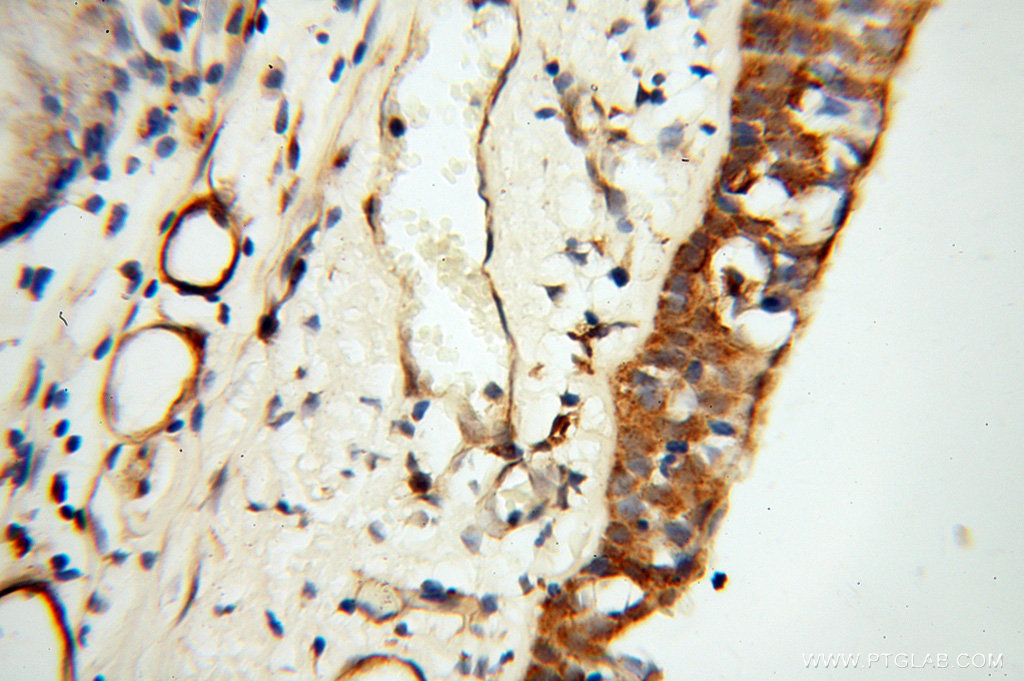 IHC staining of human trachea using 13518-1-AP (same clone as 13518-1-PBS)