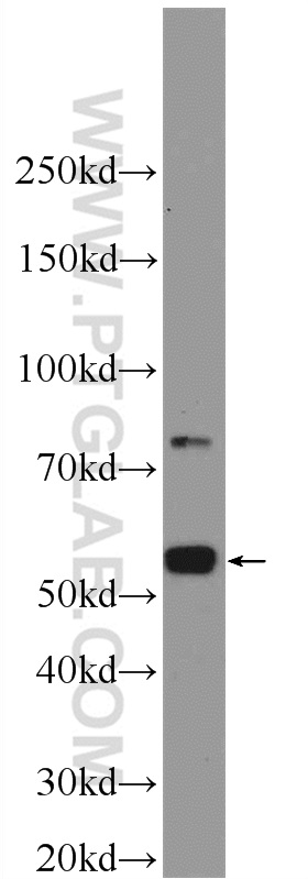 WB analysis of mouse testis using 12959-1-AP