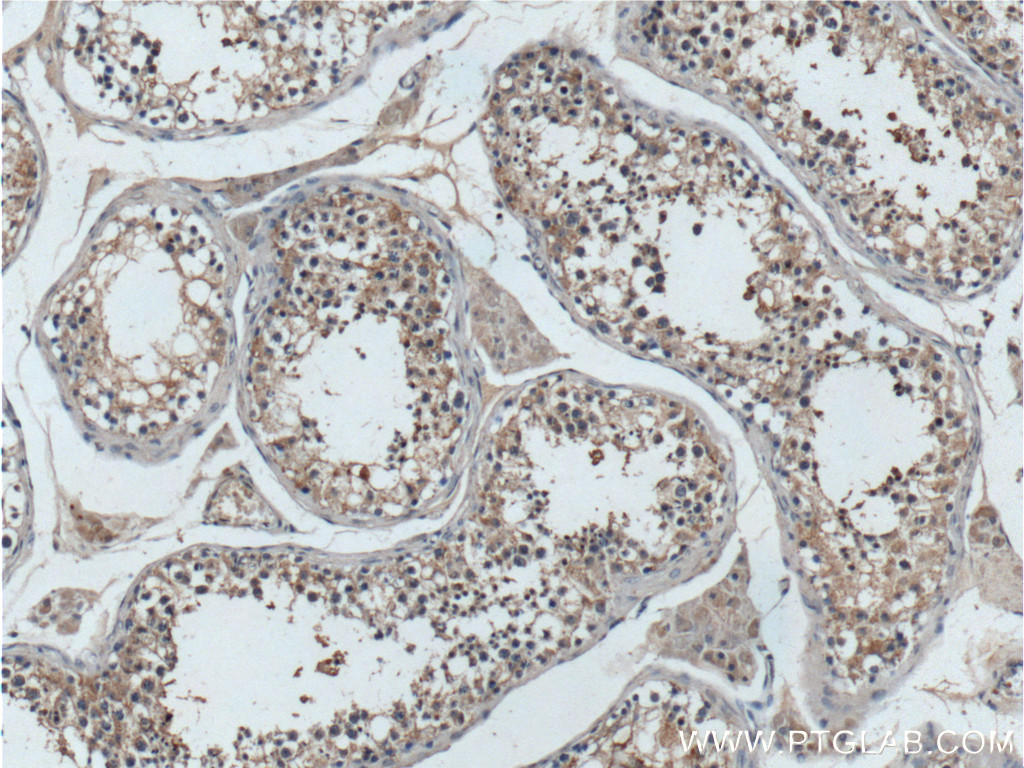 IHC staining of human testis using 15975-1-AP