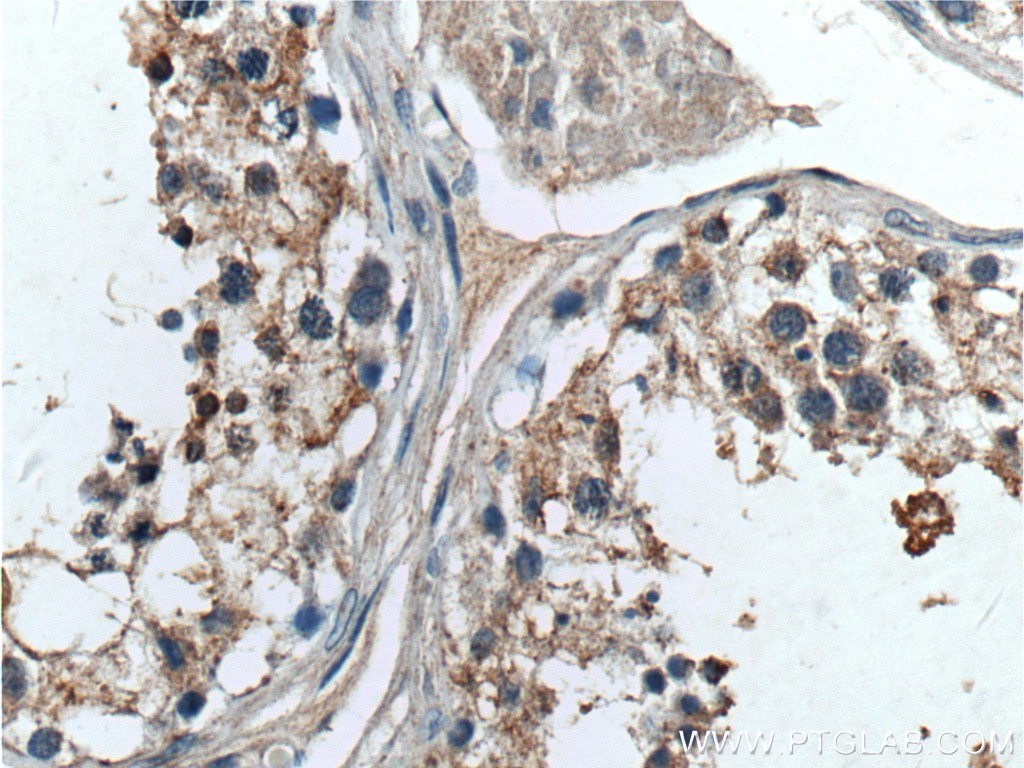 IHC staining of human testis using 15975-1-AP