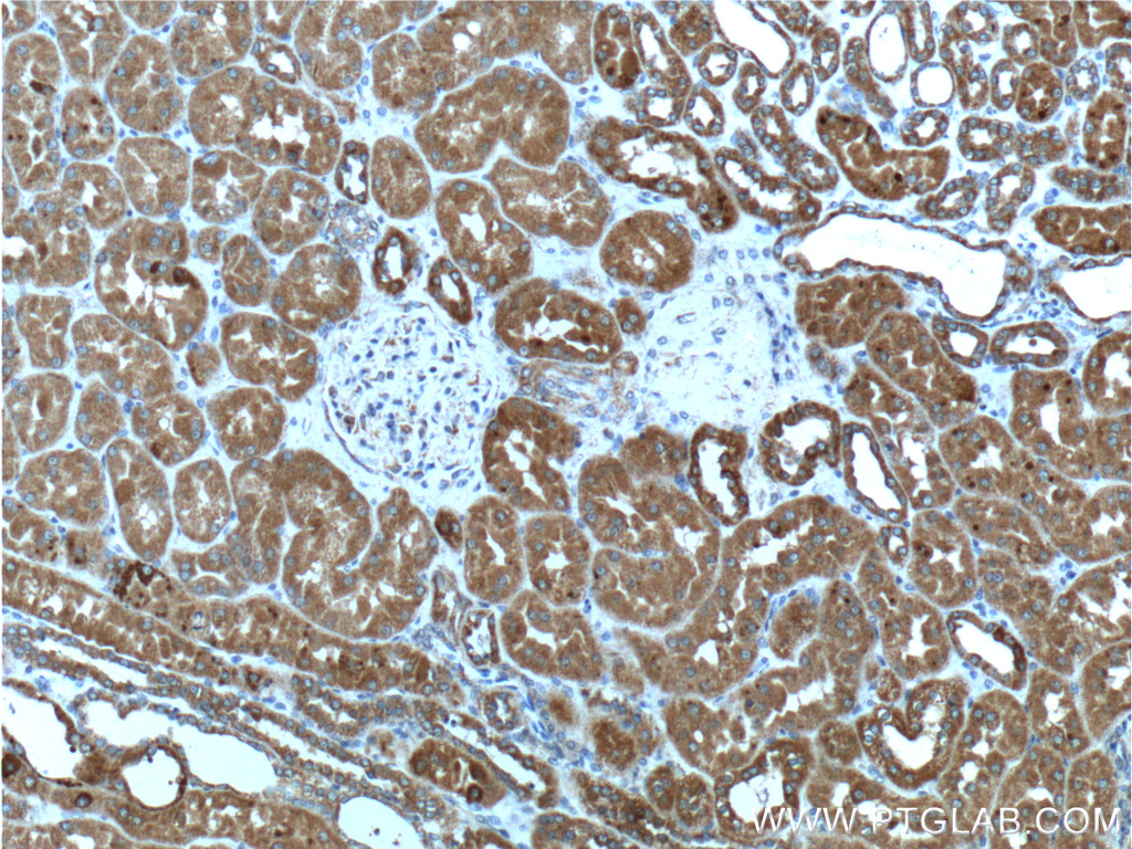 IHC staining of human kidney using 66077-1-Ig (same clone as 66077-1-PBS)