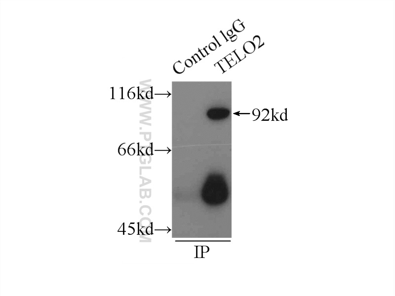 IP experiment of HepG2 using 66077-1-Ig (same clone as 66077-1-PBS)