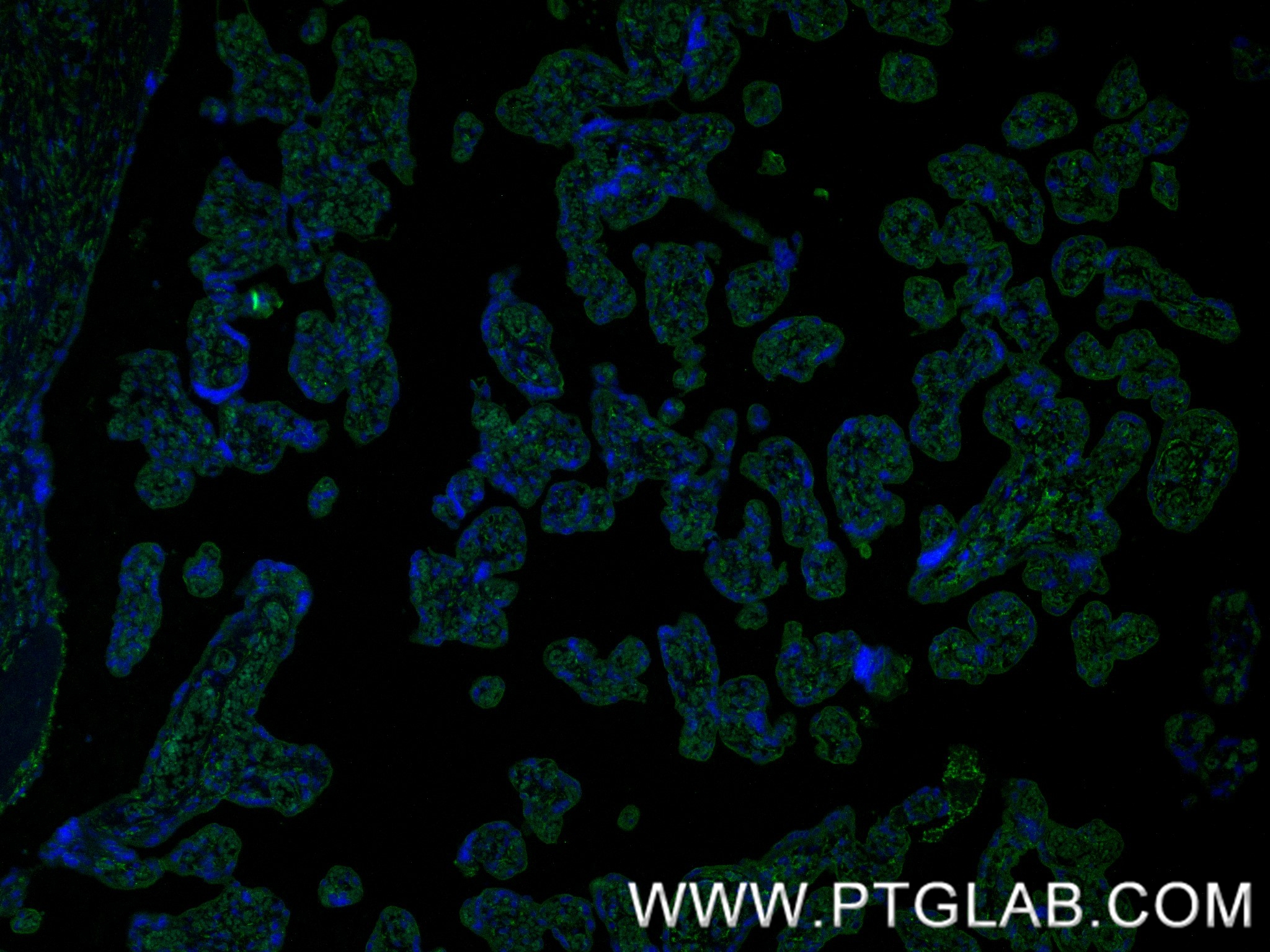 IF Staining of human placenta using 87247-1-RR