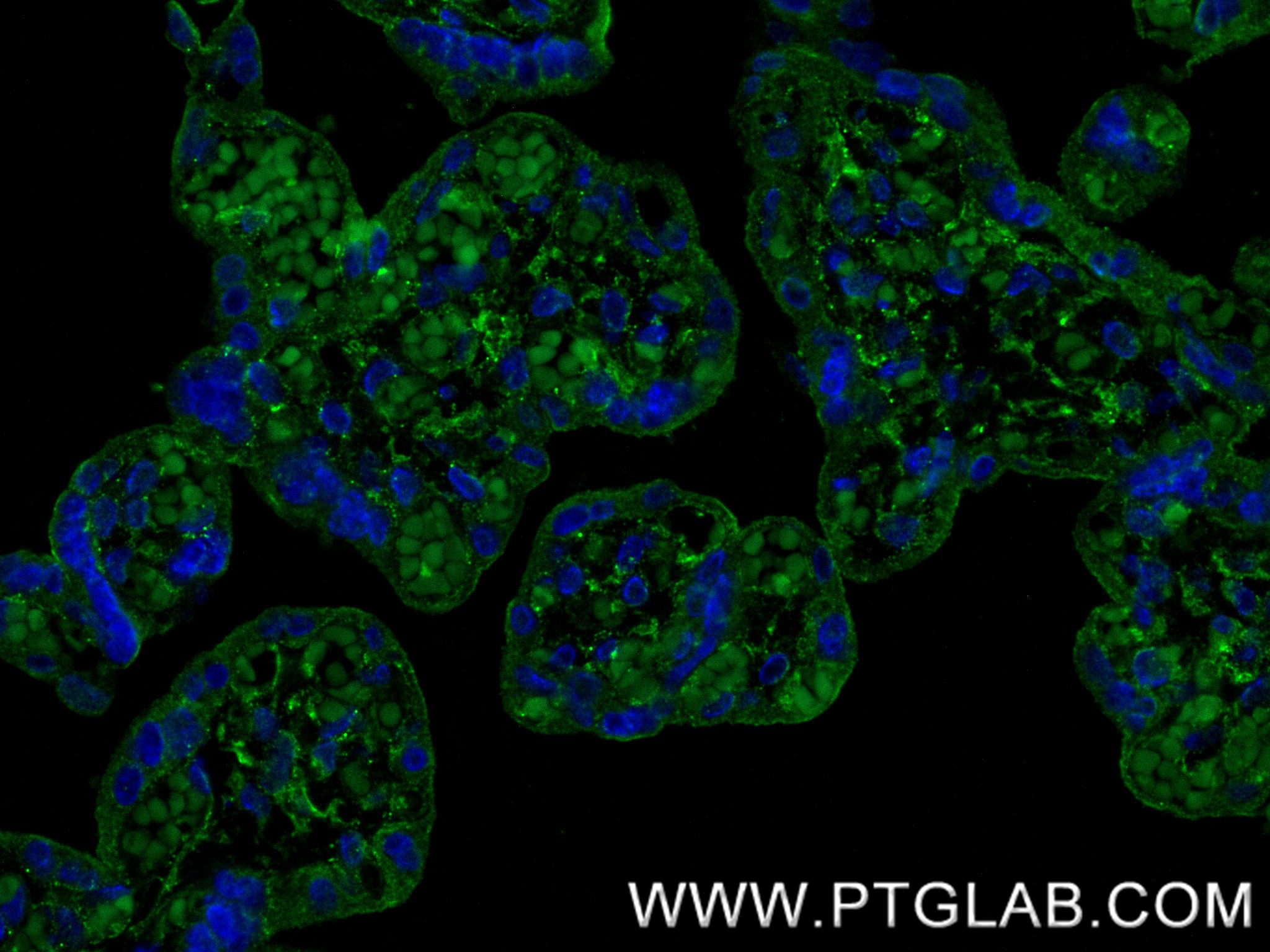 IF Staining of human placenta using 87247-1-RR