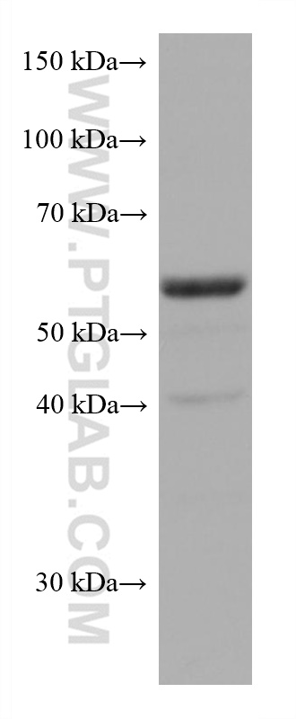 WB analysis of 4T1 using 66893-1-Ig