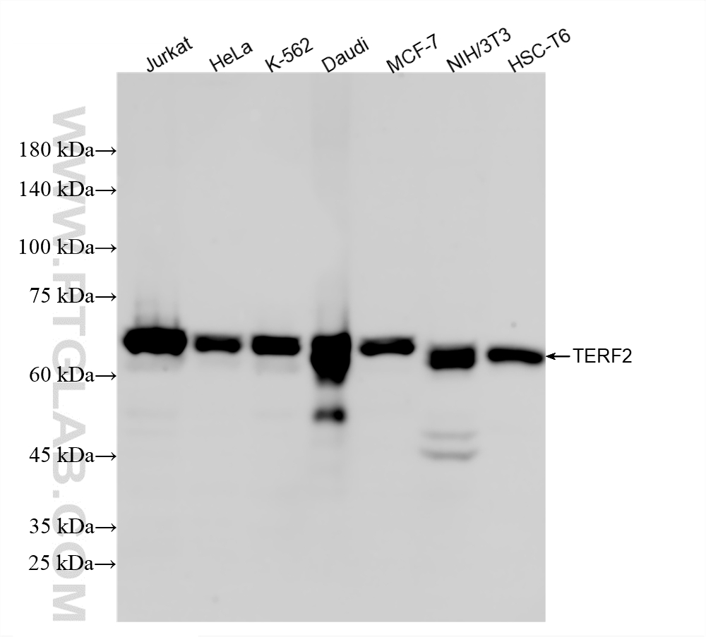 WB analysis using 87020-1-RR WB analysis using 87020-1-RR