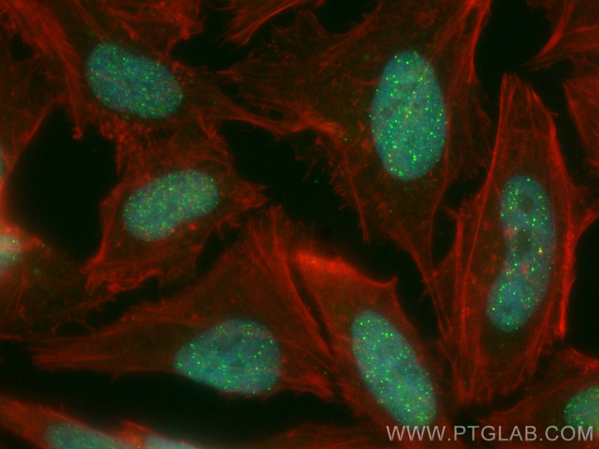 IF Staining of HeLa using CL488-14595